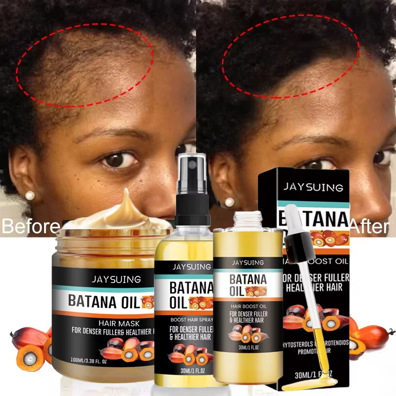 Hair Care Essence Oil Spray - Batana-Öl Dickes Haar-Serum-Spray zur Haarreparatur, Nährstoffversorgung