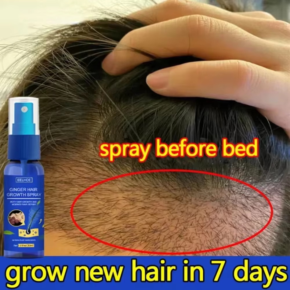 Hair Care Nutrition - Schnelles Ingwer-Haarwuchsspray für Wurzelwachstum, Anti-Haarausfall, Haarwuchs-Serum,
