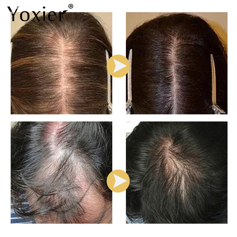 Intensive Wachstum Serum Verhi – Hair Care Treatment Bewertung und Preis