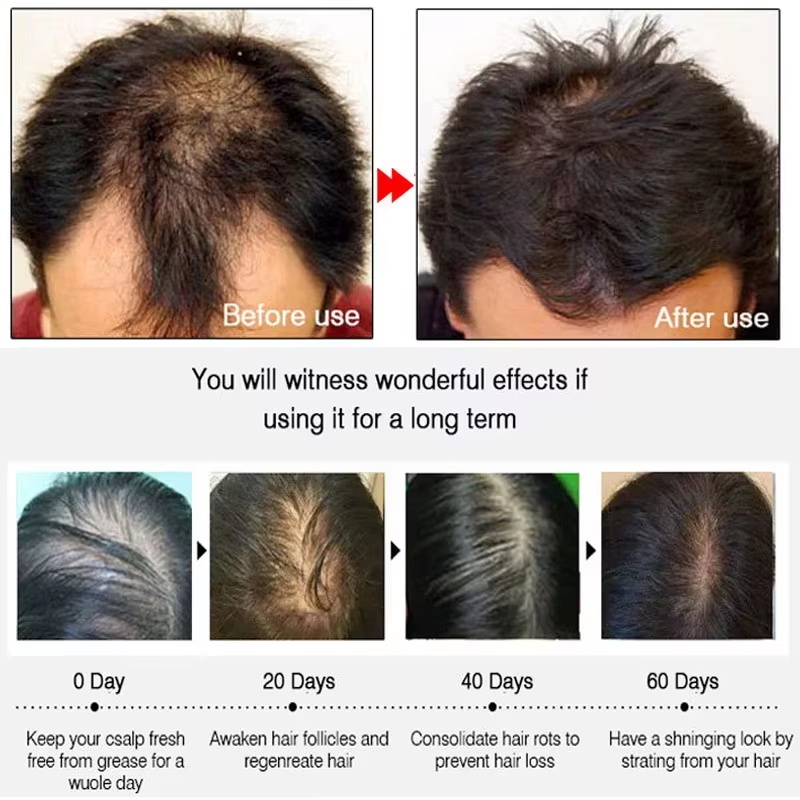 Schnelles Ingwer-Haarwuchsspra – Hair Care Nutrition Bewertung und Preis