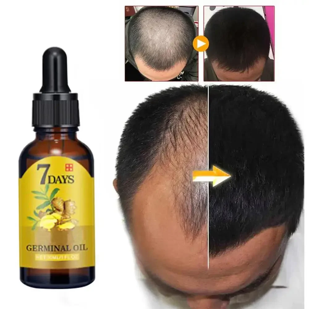 Haarwachstums-Ingwer, schnell  – Hair Care Essence Oil Spray Bewertung und Preis